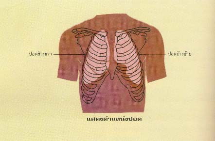 การผ่าตัดเปลี่ยนปอด