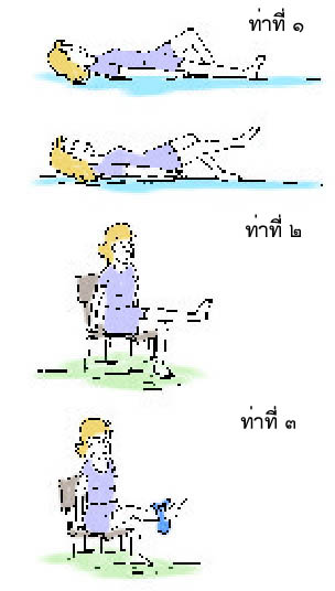 การฟื้นฟูสภาพผู้ป่วยข้อเข่าเสื่อม