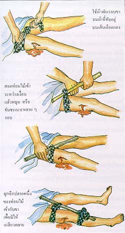 เลือดออก หรือตกเลือด