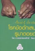 โรคข้อรูมาตอยด์