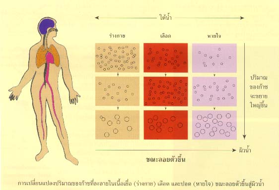 โรคลดความกด หรือโรคเคซอง หรือ โรคน้ำหีบ หรือโรคน้ำหนีบ