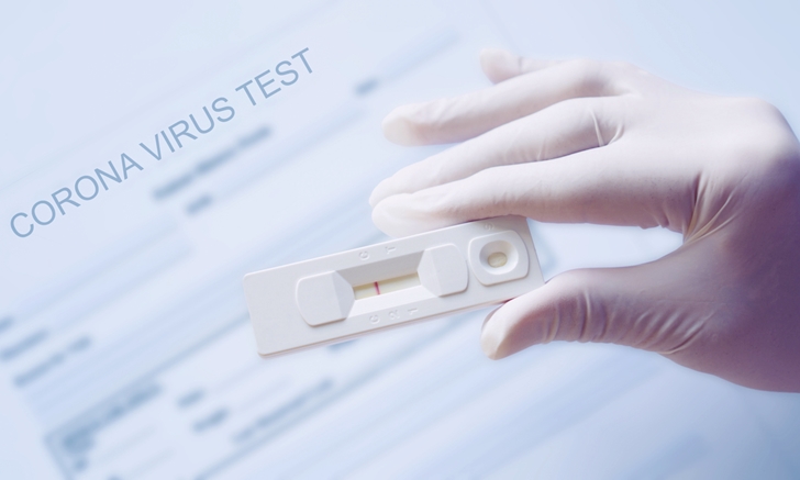 ข้อควรรู้เกี่ยวกับ Rapid Test สำหรับตรวจโรค \