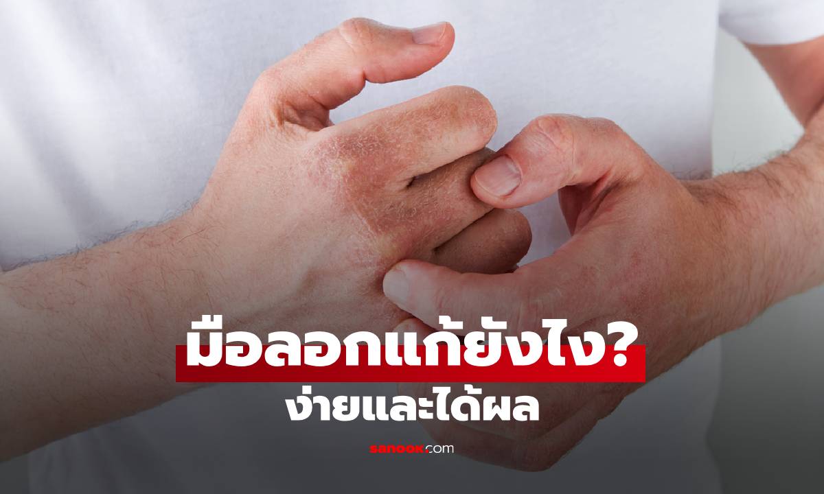 มือลอกแก้ยังไง สาเหตุและวิธีแก้แบบง่ายและได้ผล