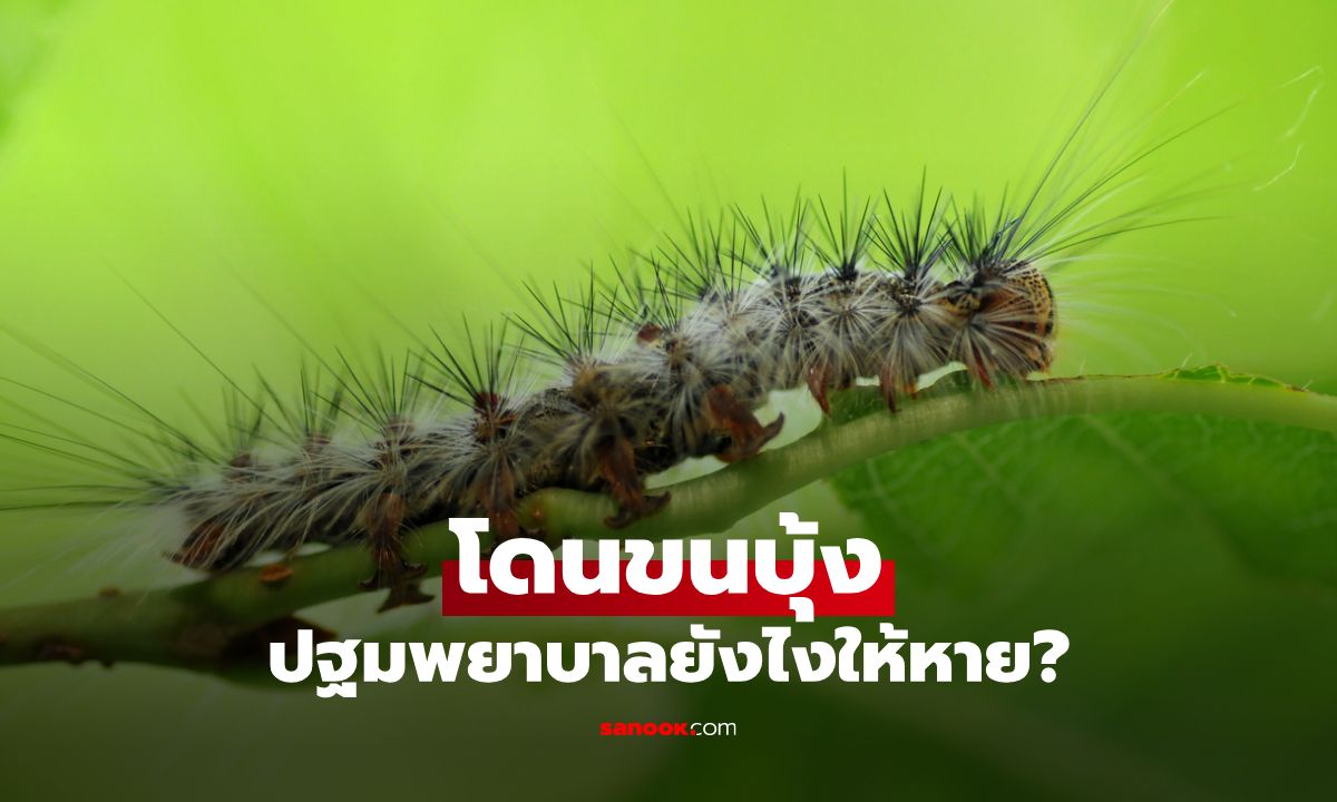 วิธีปฐมพยาบาลเมื่อโดนขนบุ้ง พร้อมทริคใช้ตำลึงแก้พิษได้จริง