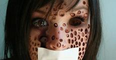 trypophobia โรคกลัวรู คำฮิตในโลกโซเชียล