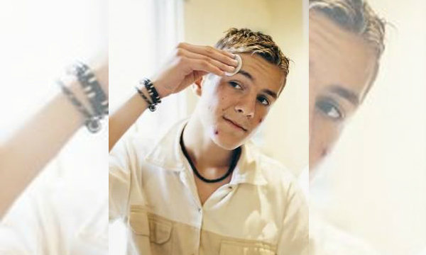 10 วิธีสุดเจ๋งรับมือปัญหาสิวแบบแมนๆ