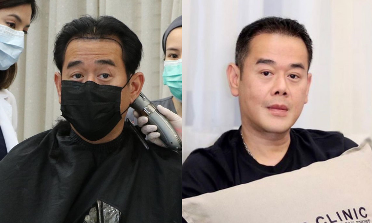 เป๊ก สัณณ์ชัย ปลูกผม อัพหน้าใหม่ เผยความหล่อใสในวัย 47 ปี