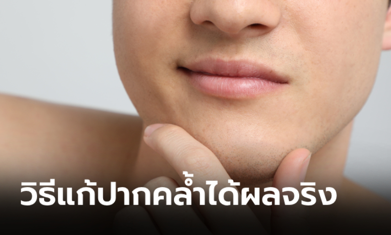 6 วิธีแก้ริมฝีปากดำคล้ำของผู้ชาย ทำง่ายได้ผลดีจริง