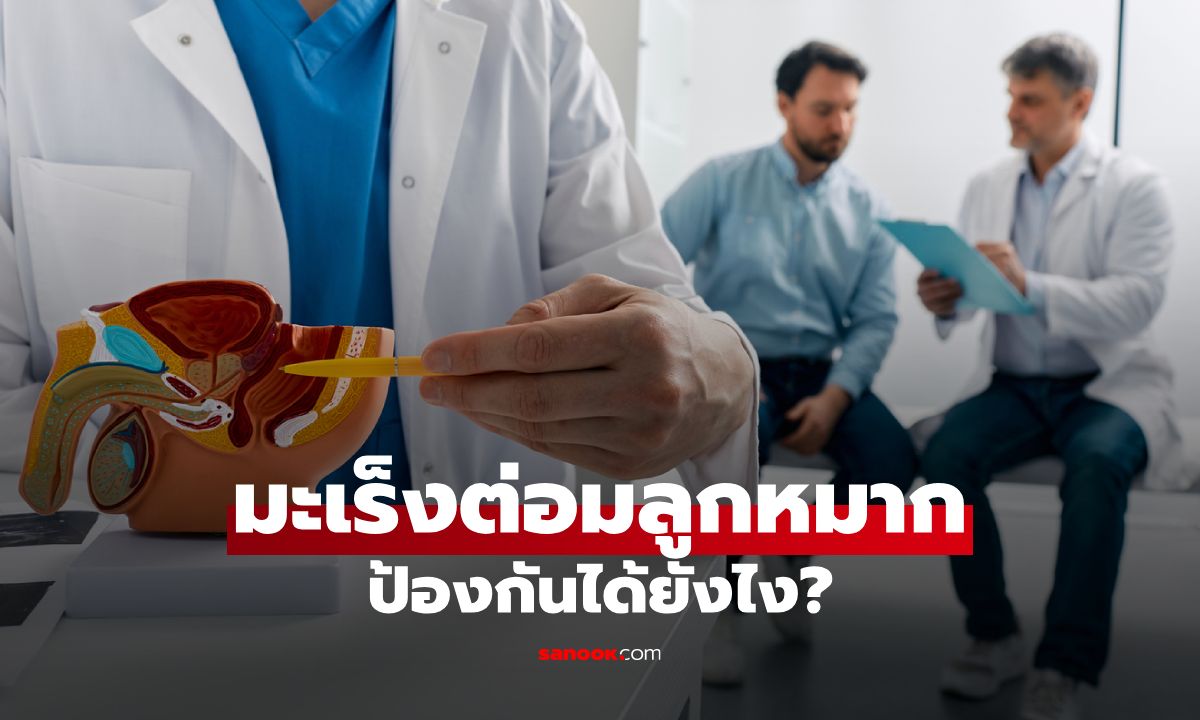 5 วิธีป้องกันมะเร็งต่อมลูกหมาก ที่คุณผู้ชายวัย 40+ ควรเริ่มทำตั้งแต่วันนี้