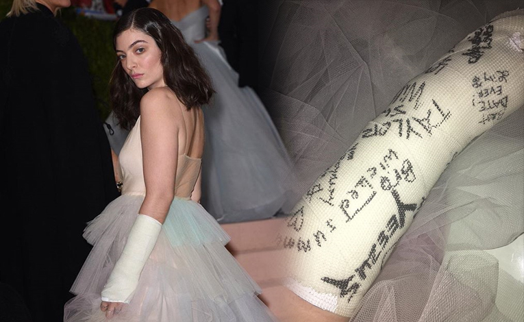 Lorde แขนหักยังสตรอง! ยื่นเฝือกแขนให้เซเล็บในงาน Met Gala เซ็นให้