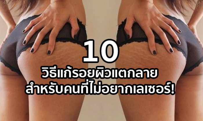10 วิธีแก้รอยผิวแตกลาย สำหรับคนที่ไม่อยากเลเซอร์!