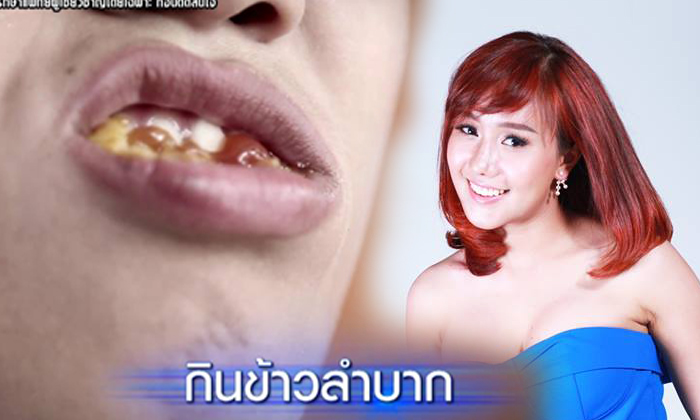 สาวเรียนเก่งแต่มีอุปสรรคที่หน้าตา! ศัลยกรรมนี้เพื่อความหวังของครอบครัว