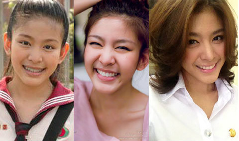 ทำไมเค้าถึงว่า หนูนา ศัลยกรรม